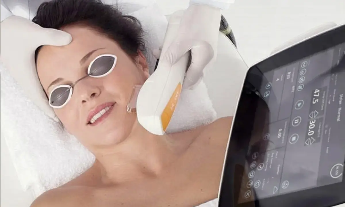 Intense Pulsed Light (IPL)